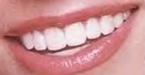 Where smiles are free!